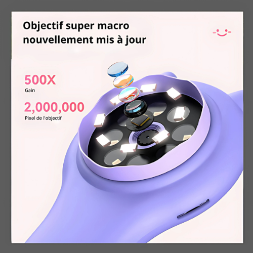 TendresseLens™ MiniScope Tendresse